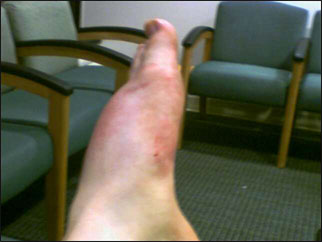 foot_1.jpg