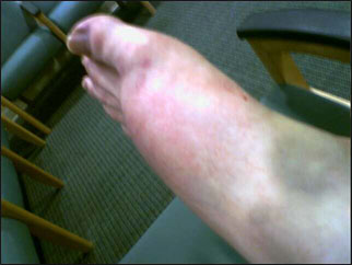 foot_2.jpg