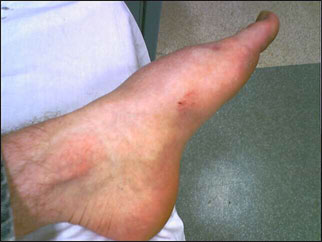 foot_3.jpg