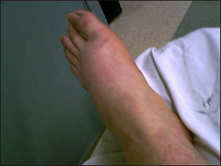 foot_4.jpg