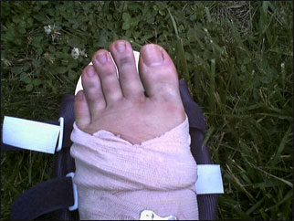 foot_5.jpg