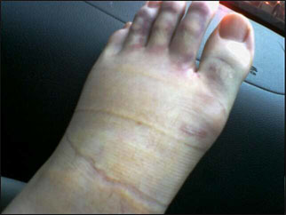 foot_6.jpg