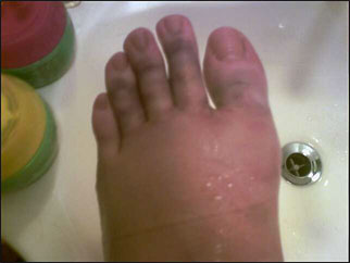 foot_7.jpg